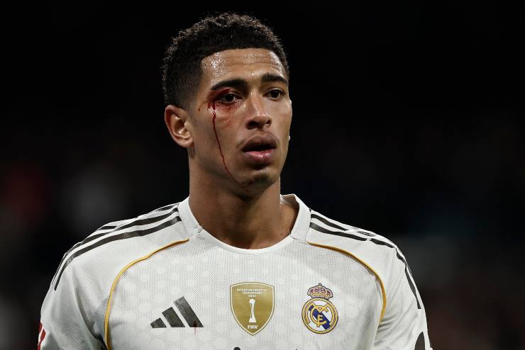 Bellingham sanguinante